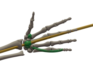 Total Awareness of Weight